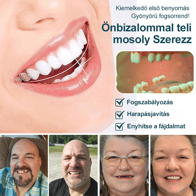 Tökéletes Mosoly Fogpótlás Készlet