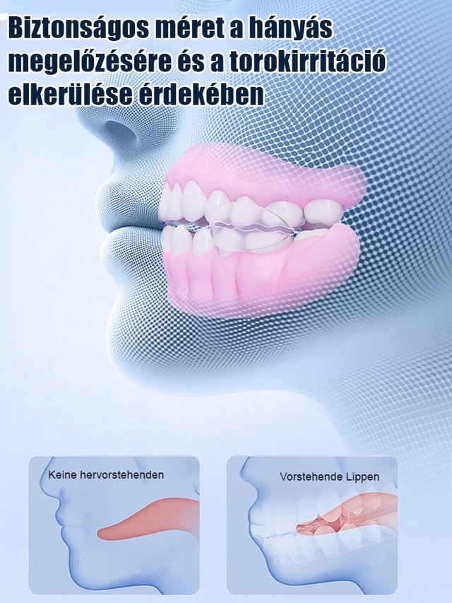 [Új brit kutatási eredmények] Szilikon szimulációs fogszabályozó fogszabályozó