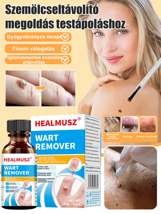 Testápoló szemölcs eltávolító megoldás