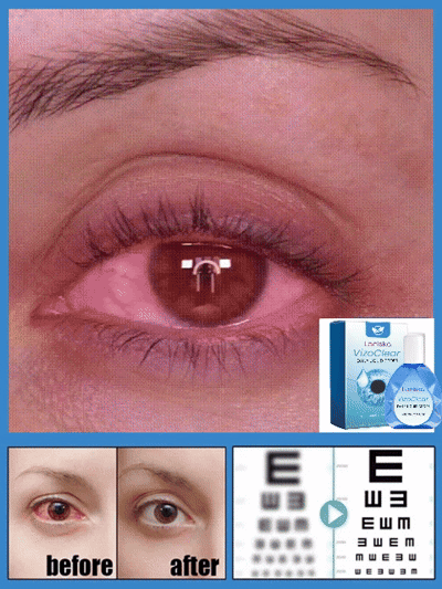 Látásjavító Szemcsepp-Nincs szükség műtétre a látás helyreállításához!